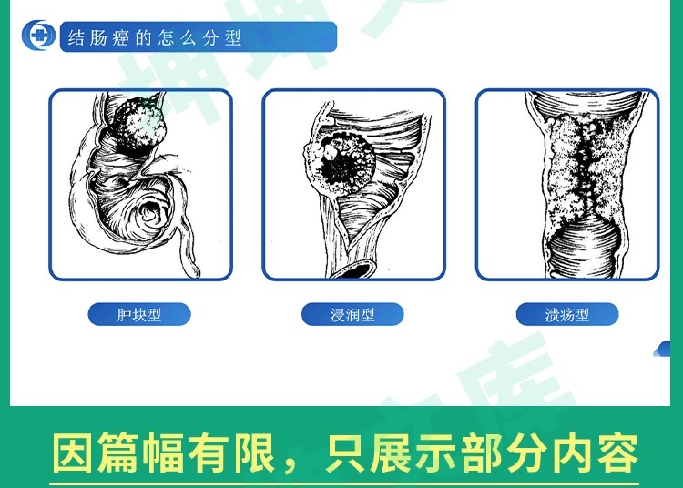 图片[17]-医学护理查房ppt模板内外科护理业务教学查房完整内容课件护理课-大怪兽分享
